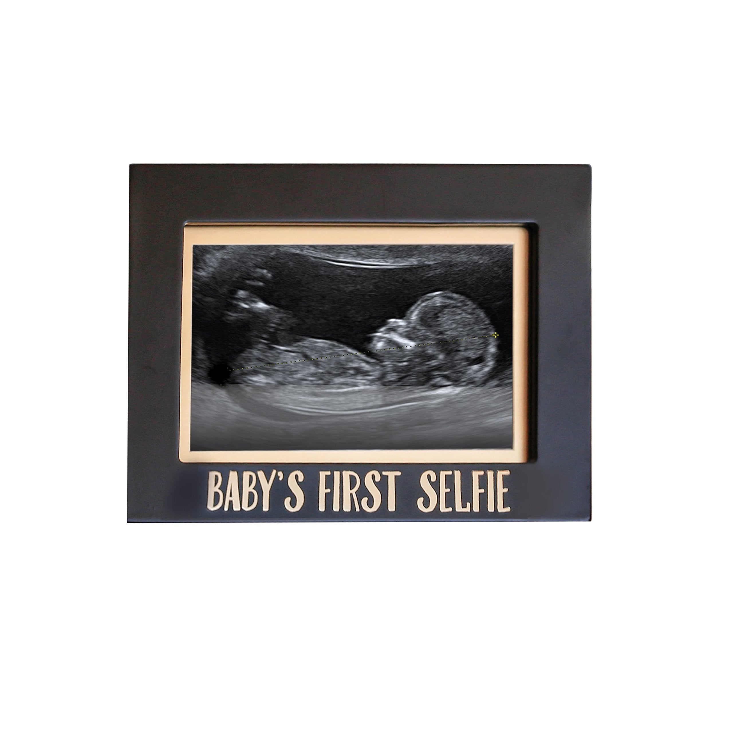 Baby Ultrasound Picture Frame